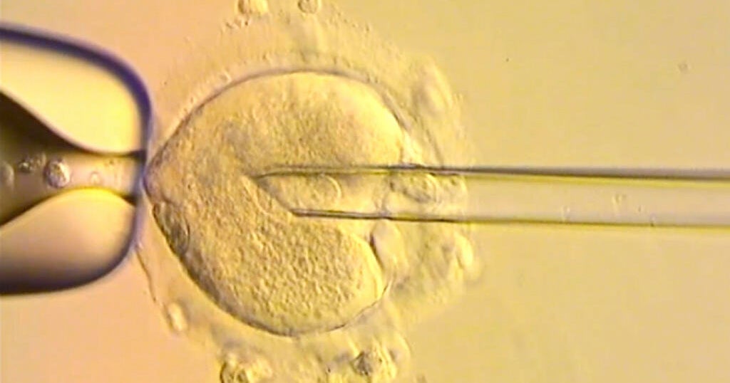 8 babies born with DNA from 3 people in world-first IVF trial 